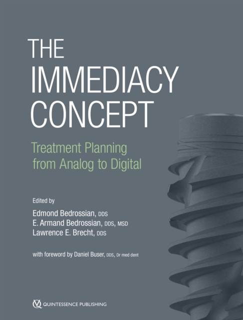 Immediacy Concept