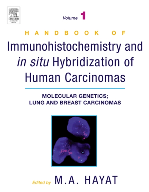 Handbook of Immunohistochemistry and in Situ Hybridization of Human Carcinomas