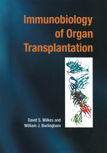Immunobiology of Organ Transplantation