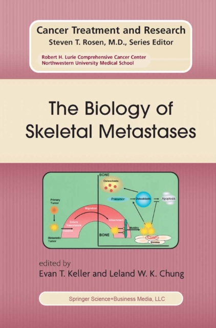 Biology of Skeletal Metastases