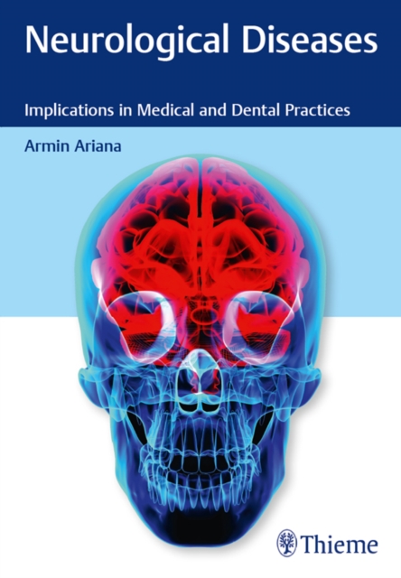 Neurological Diseases