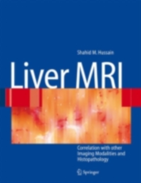 Liver MRI