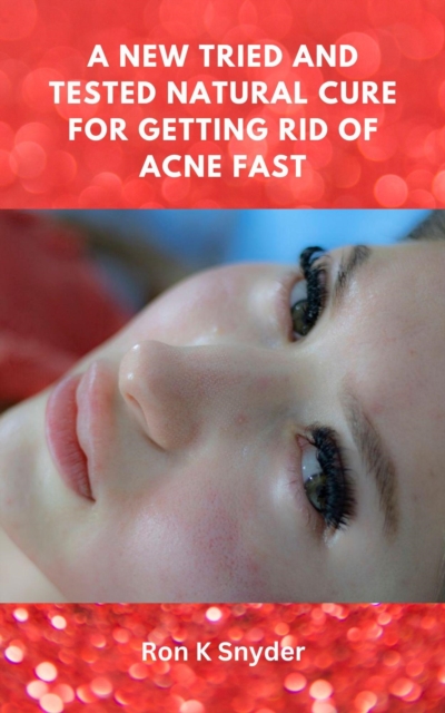 New Tried And Tested Natural Cure For Getting Rid Of Acne Fast