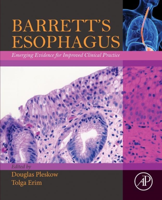Retrograde Ureteroscopy
