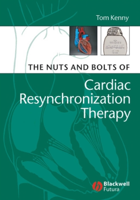 Nuts and Bolts of Cardiac Resynchronization Therapy