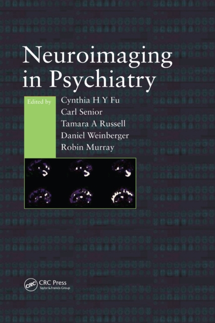 Neuroimaging in Psychiatry