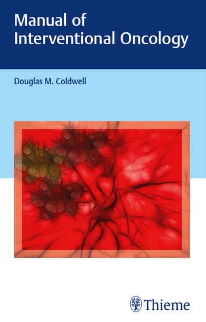 Manual of Interventional Oncology