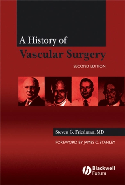 History of Vascular Surgery