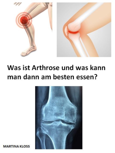 Was ist Arthrose und was kann man dann am besten essen?