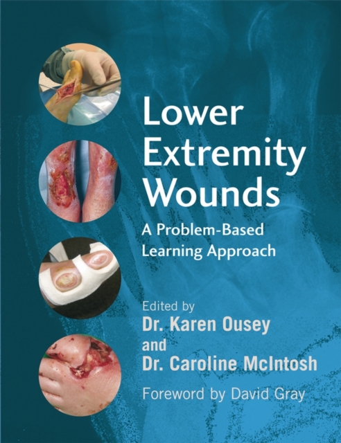 Lower Extremity Wounds