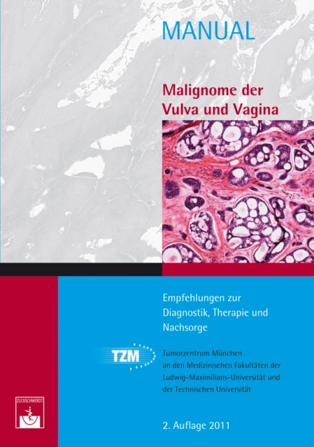 Malignome der Vulva und Vagina