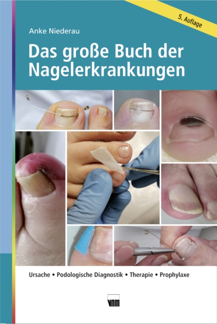 Das große Buch der Nagelerkrankungen