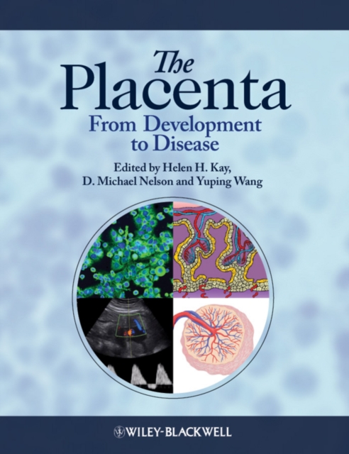 Placenta