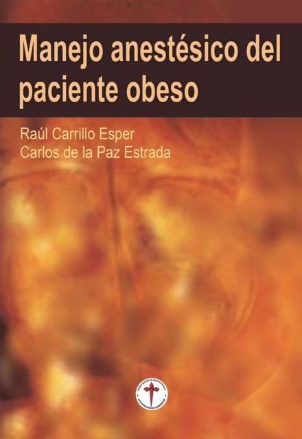 Manejo anestesico del paciente obeso