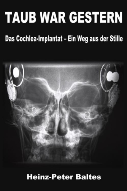 TAUB WAR GESTERN