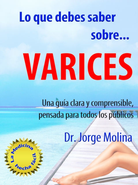 Lo que debes saber sobre... Varices