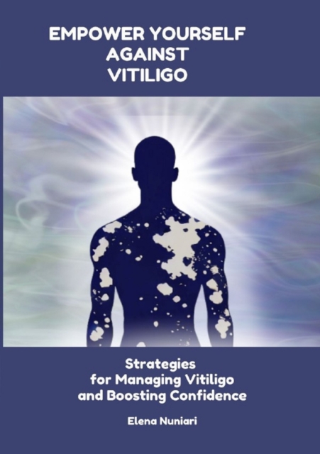 Empower Yourself Against Vitiligo