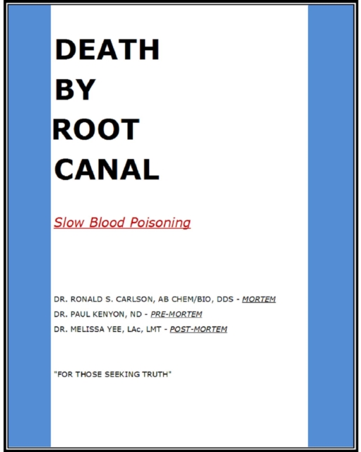 Death By Root Canal