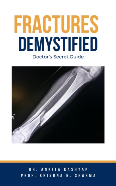 Fractures Demystified: Doctor's Secret Guide