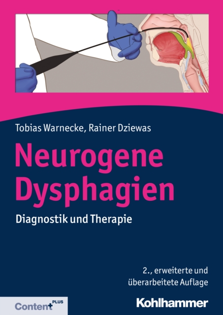 Neurogene Dysphagien