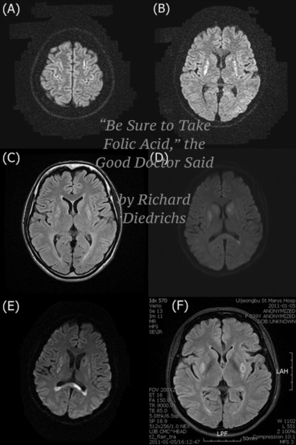 &quote;Be Sure to Take Folic Acid,&quote; the Good Doctor Said