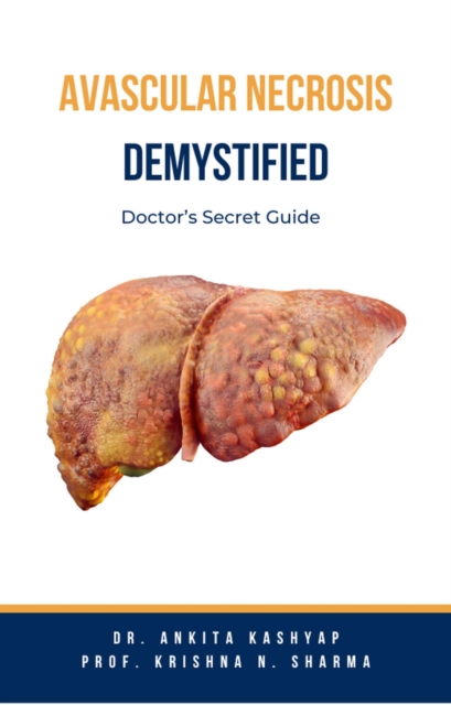 Avascular Necrosis Demystified: Doctor's Secret Guide