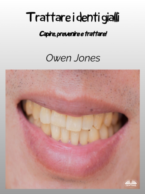 Trattare I Denti Gialli