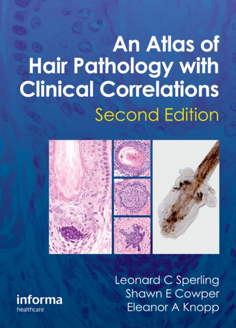 Atlas of Hair Pathology with Clinical Correlations