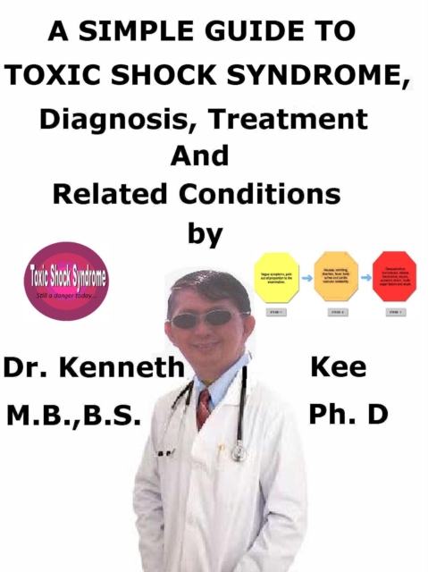Simple Guide to Toxic Shock Syndrome, Diagnosis, Treatment and Related Conditions