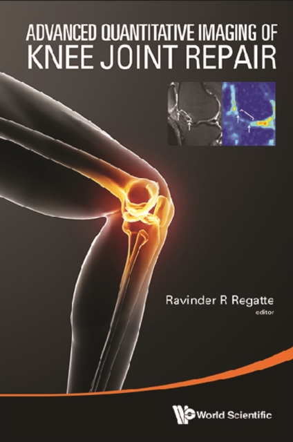 Advanced Quantitative Imaging Of Knee Joint Repair