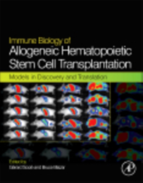 Immune Biology of Allogeneic Hematopoietic Stem Cell Transplantation