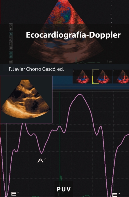 Ecocardiografía-Doppler