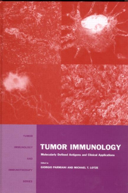 Tumor Immunology
