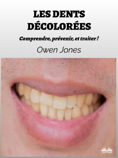 Les Dents Décolorées