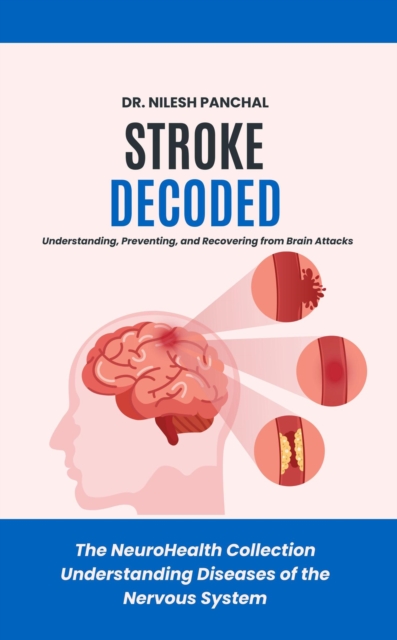 Stroke Decoded: Understanding, Preventing, and Recovering from Brain Attacks