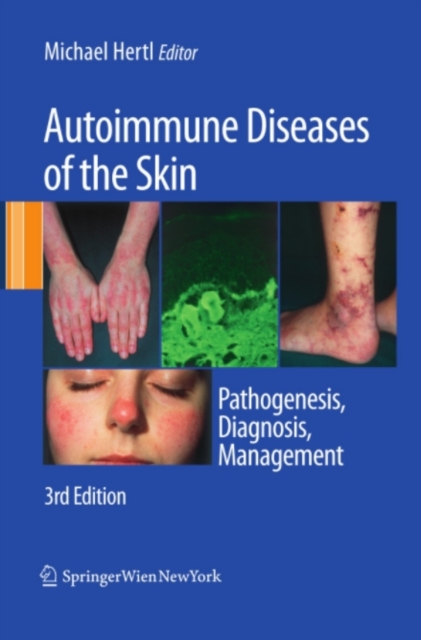 Autoimmune Diseases of the Skin