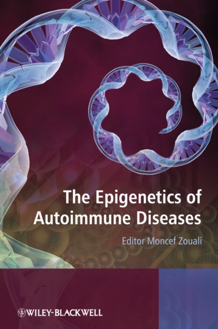 Epigenetics of Autoimmune Diseases