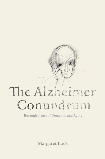 Alzheimer Conundrum