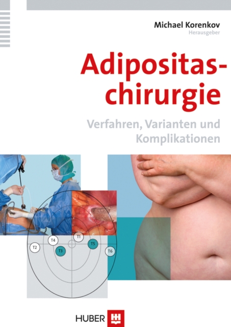 Adipositaschirurgie