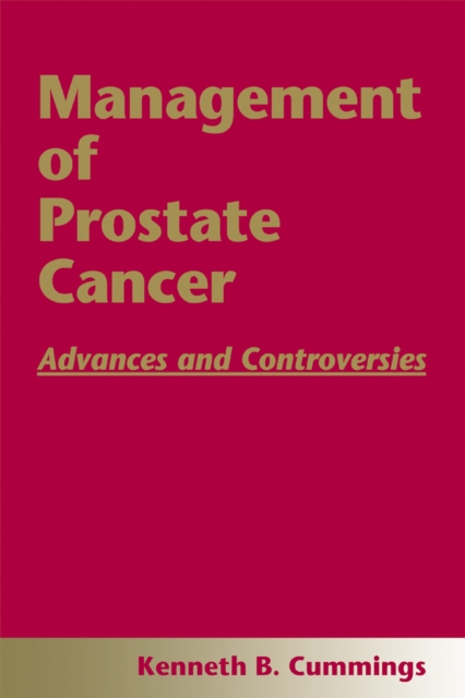 Management of Prostate Cancer