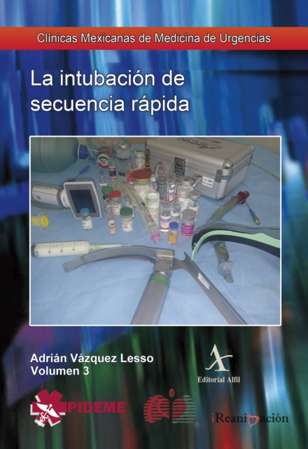 La intubación de secuencia rápida
