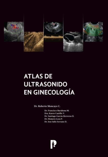 Atlas de ultrasonido en ginecología