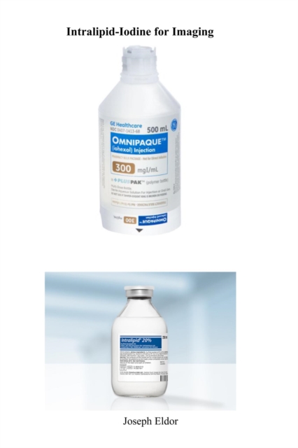 Intralipid-Iodine for Imaging