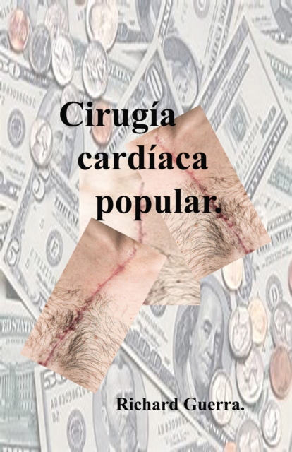 Cirugia Cardiaca Popular.