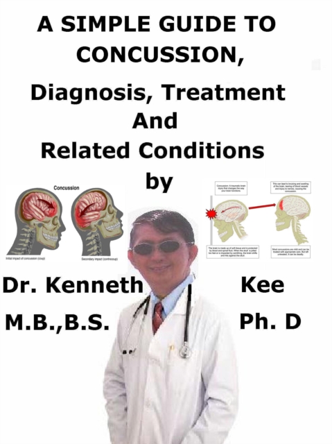 Simple Guide to Concussion, Diagnosis, Treatment and Related Conditions
