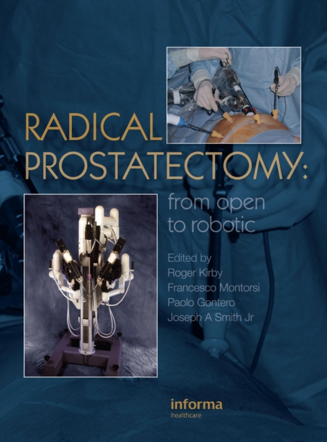 Radical Prostatectomy