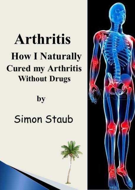 Arthritis How I Naturally Cured My Arthritis Without Drugs
