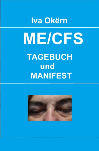 ME/CFS