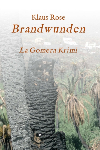 Brandwunden