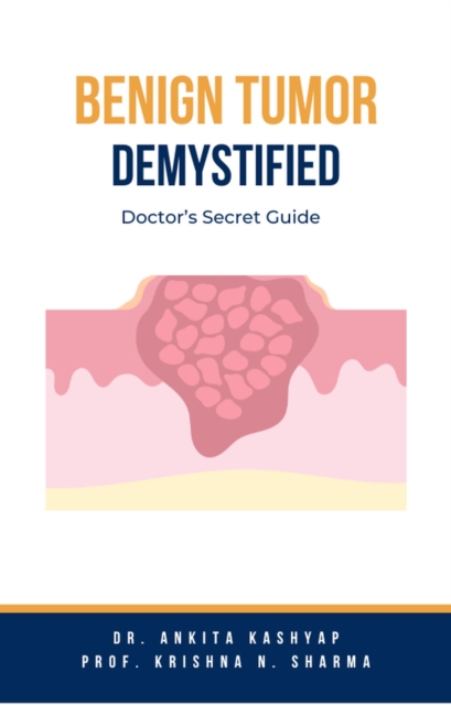 Benign Tumor Demystified: Doctor's Secret Guide